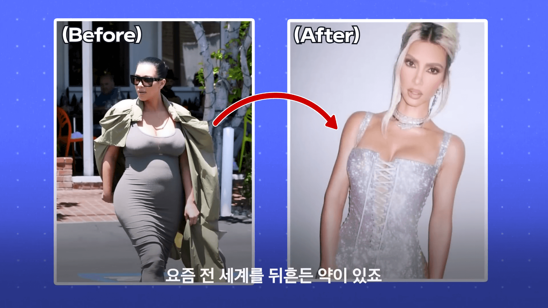 배우 '킴 카다시아' 위고비 주사형 비만 치료제 사용 전과 사용 후 비교 사진