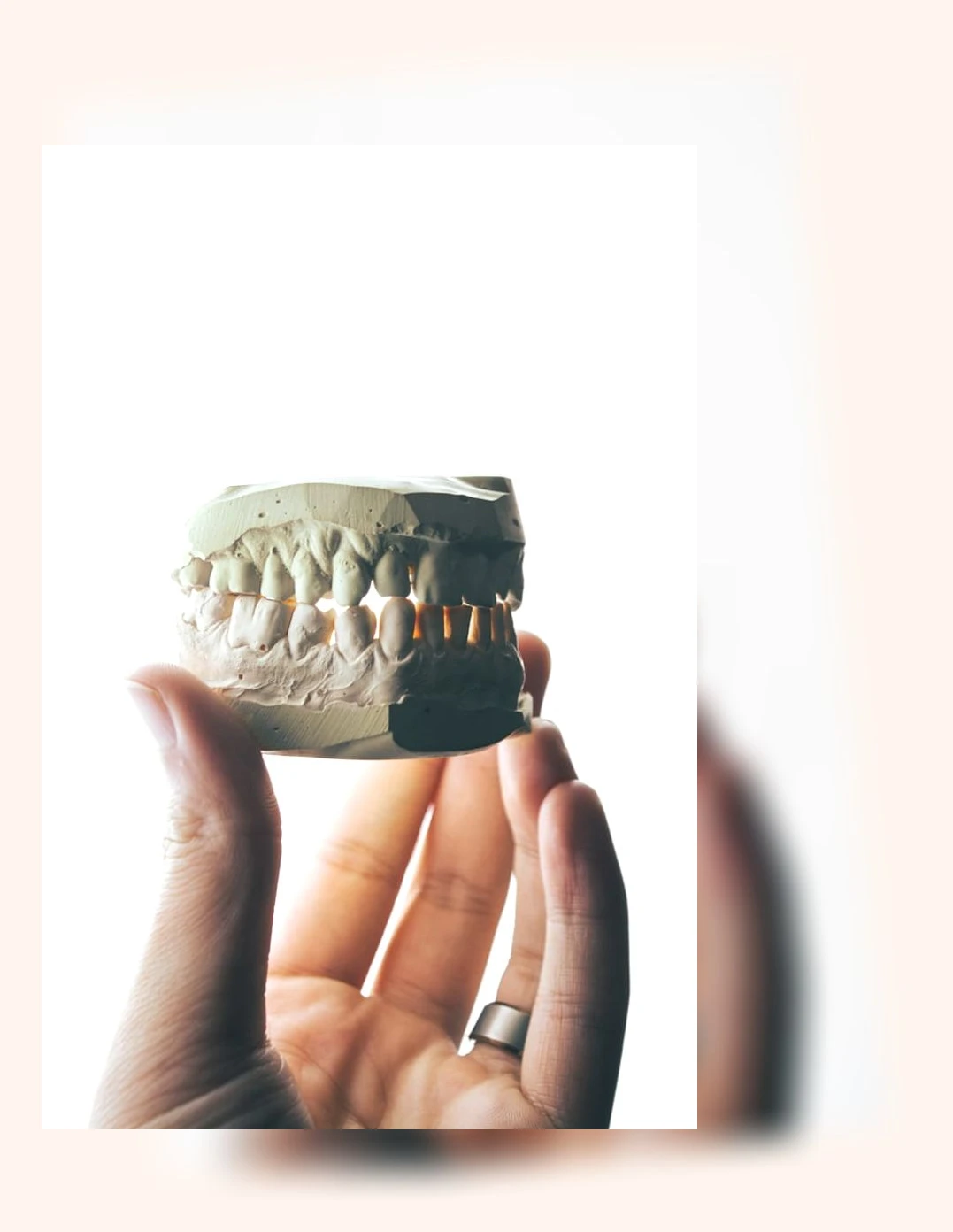 30대 전악 임플란트_2_subsection