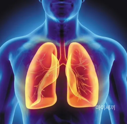 폐 통증