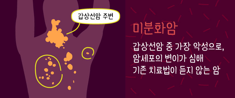갑상선암