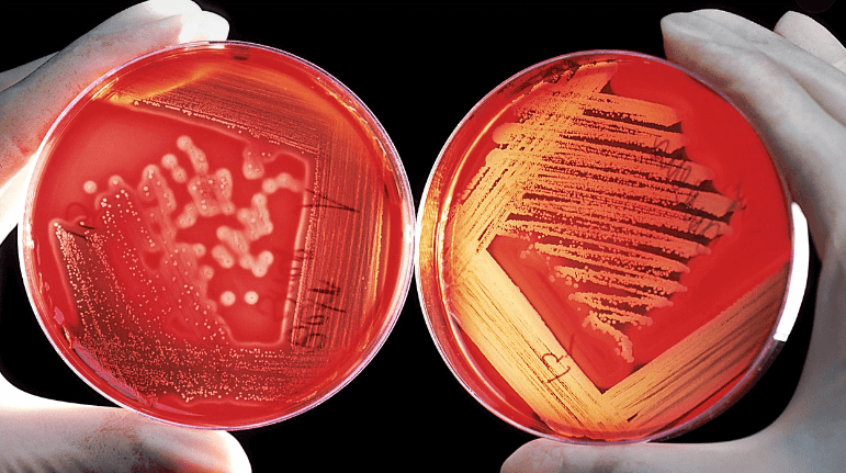 알테오젠-주가-전망-머크매각-알아보기