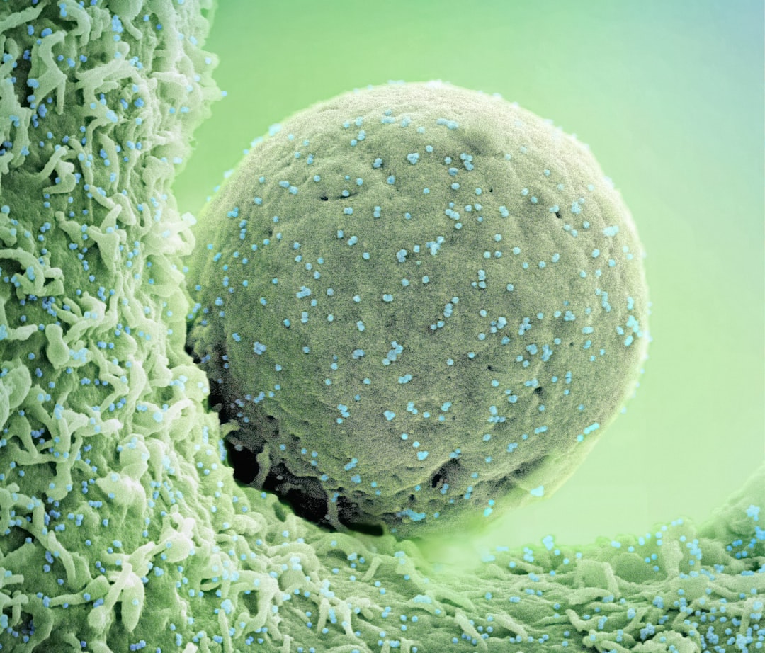 NK cell therapy