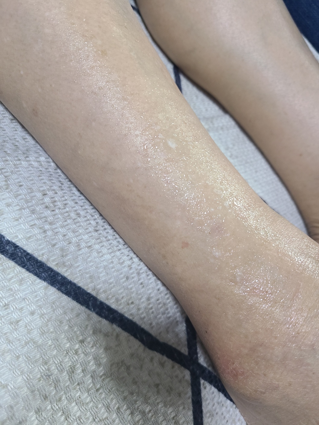 아니모 뿌리는 마그네슘 클라우드 스프레이 스포츠 제형