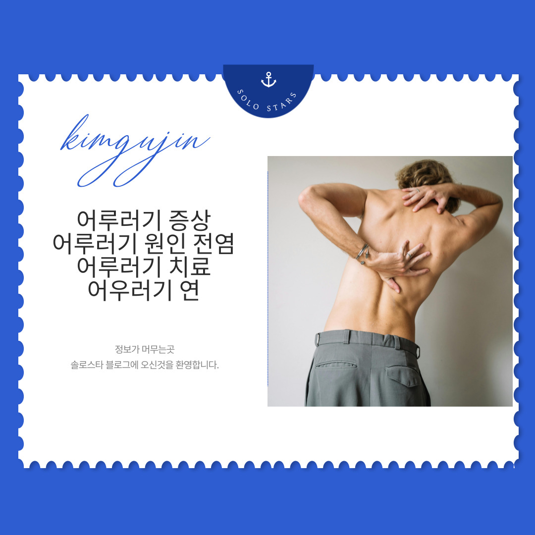 어루러기 사진