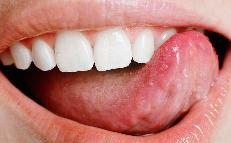 혓바늘 자주 묻는 질문 FAQ