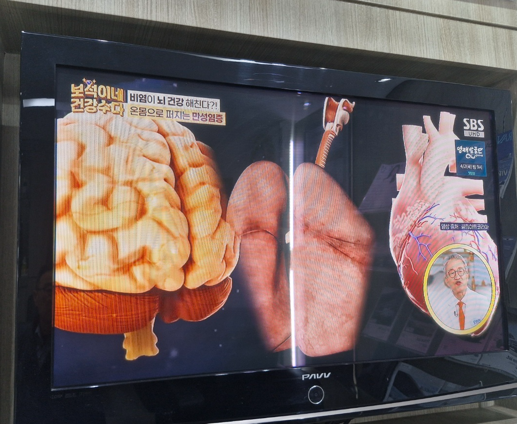 남편+아내의 코골이가 질병의 신호?(비염 방치하면 페농양+부비동염+뇌수막염 위험성 30%이상 높아진다.)