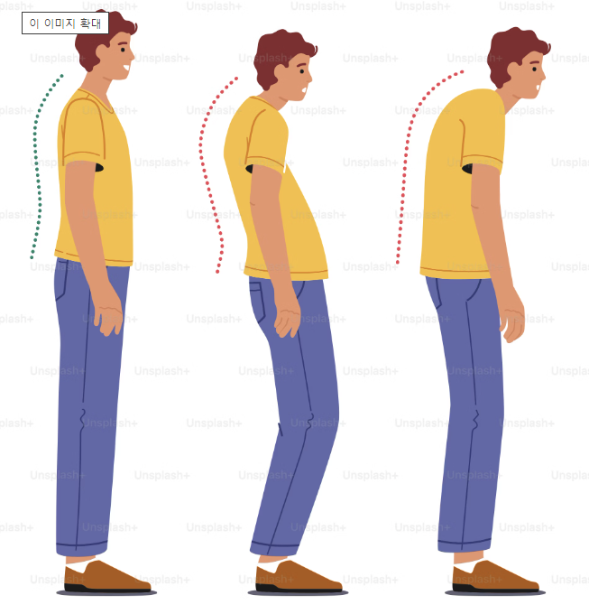 골다공증 원인 증상 검사 및 치료