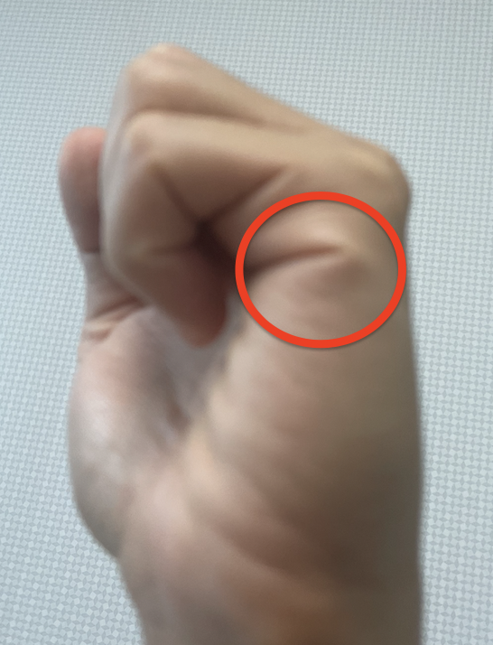 급똥 참는법