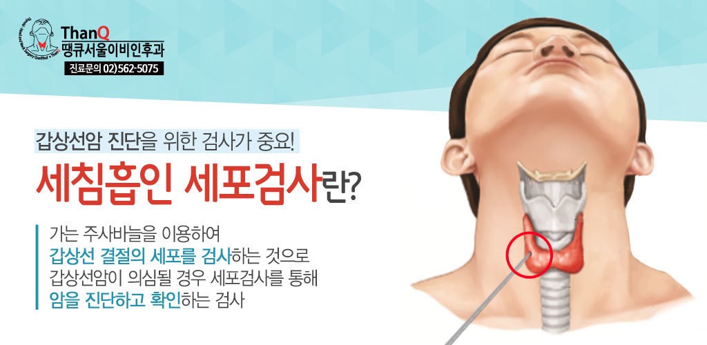 갑상선암