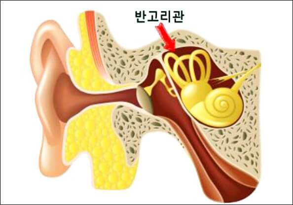 이석증 위치