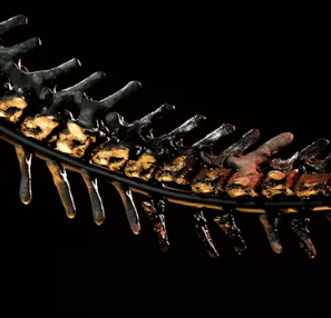 골다공증 초기증상 원인 치료방법