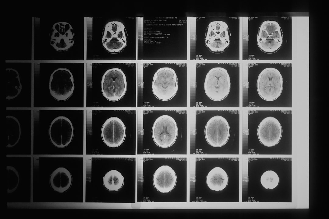 Neurosurgery