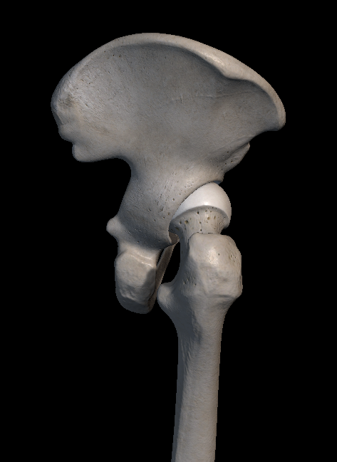 고관절 통증 원인 증상 치료법