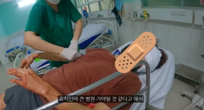 노홍철-부상