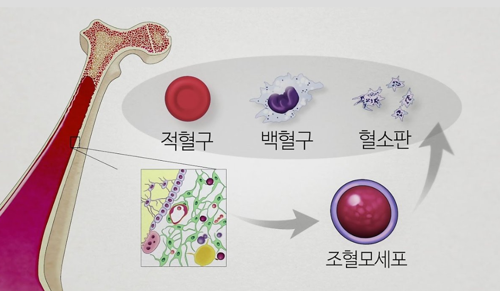 혈액-관련-질환