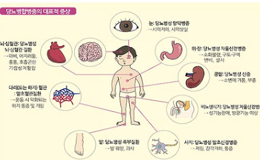 당뇨병 초기증상