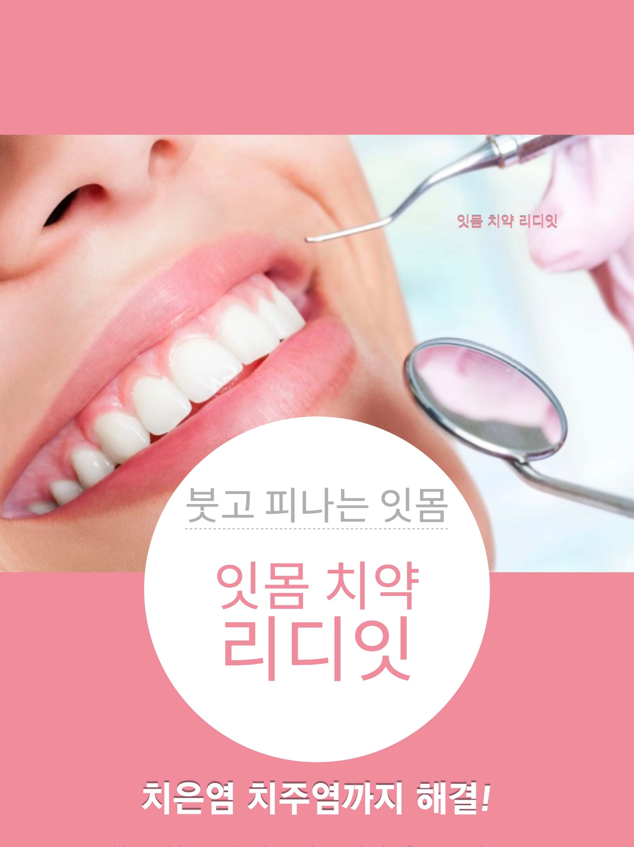 리디잇 치약 효능 효과 내돈내산 후기 부작용 리디에뜨 치약