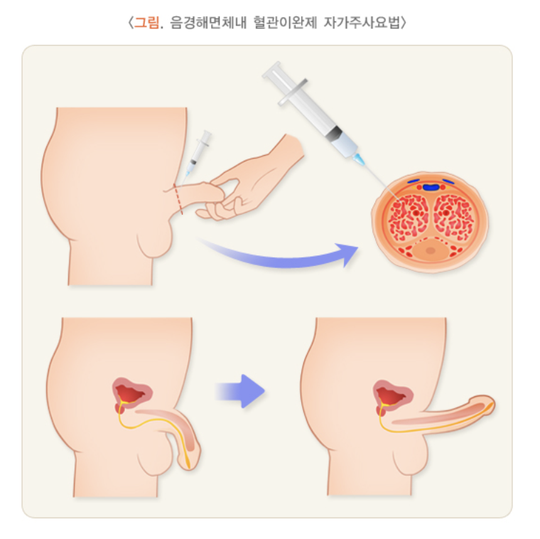 자가주사 요법
