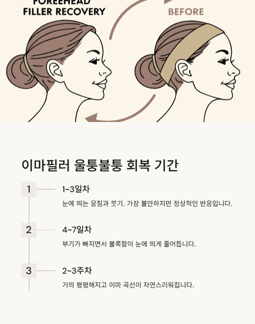이마필러 울퉁불퉁 회복 기간