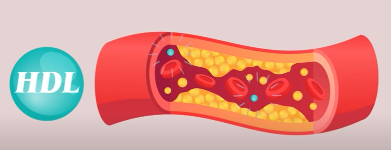 고지혈증 약 없이 건강한 혈관 만드는 법