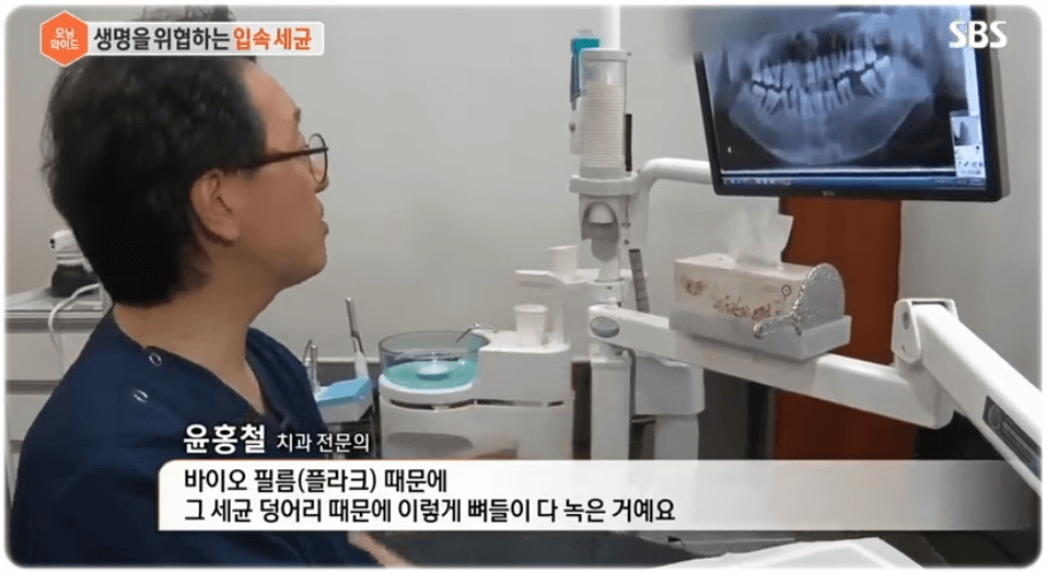 양치 후 가글