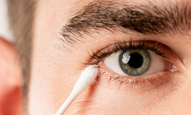 눈꼽이 잘 끼는 이유&amp;#44; 유난히 많이 생기는 원인