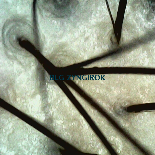 탈모 극복 프로젝트 - 정수리 두피 모습이다.