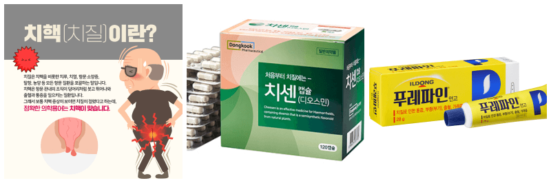 치질이란, 치센, 푸레파인 사진