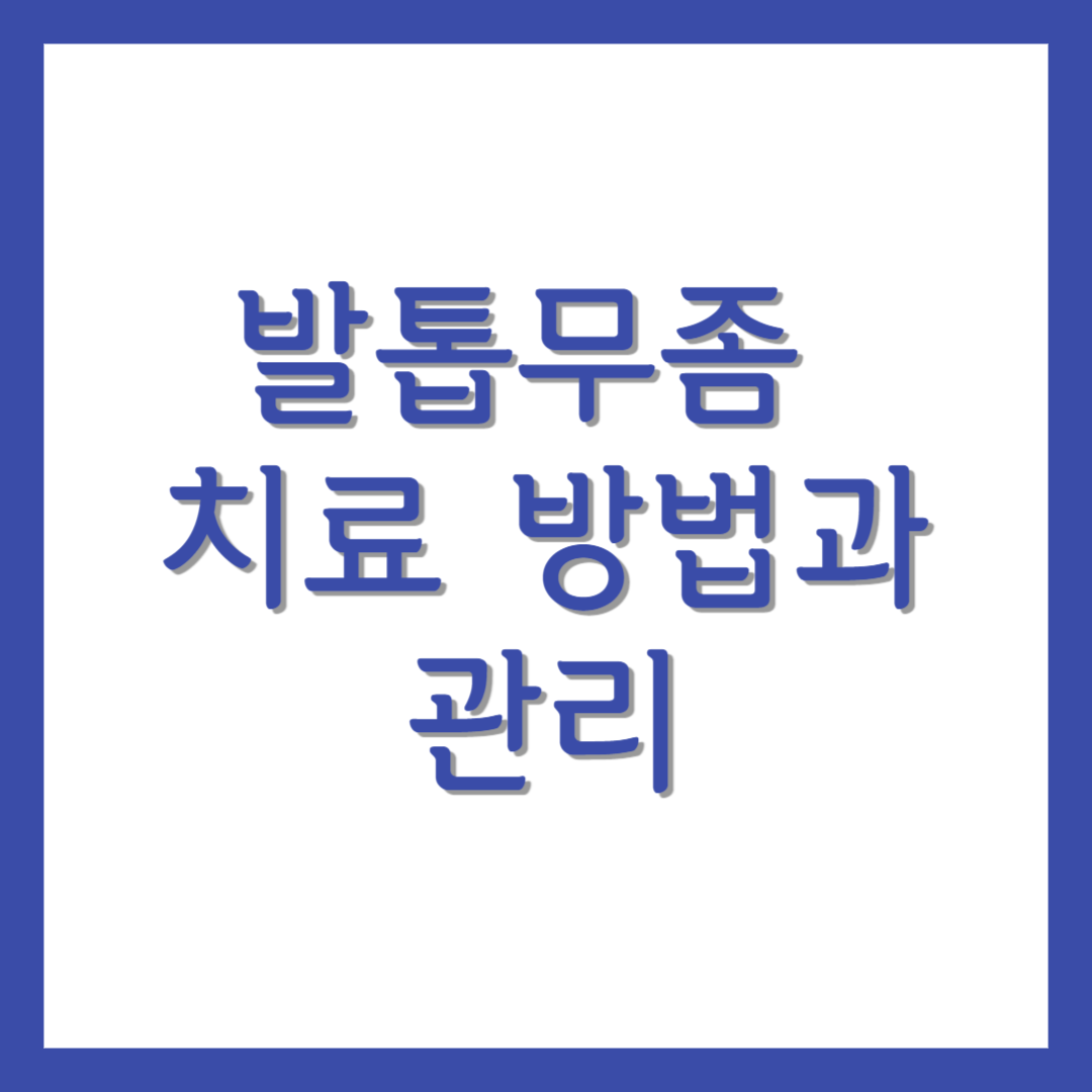 발톱무좀 치료 방법과 관리