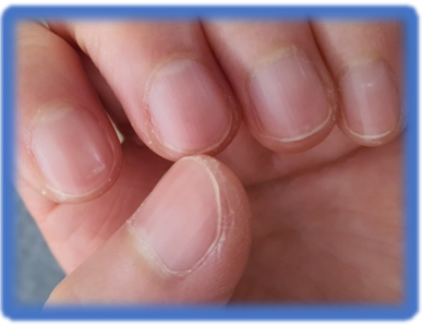 잘 씻지 않는 부위 손톱