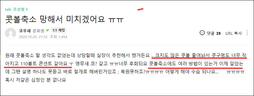 콧볼축소 후회