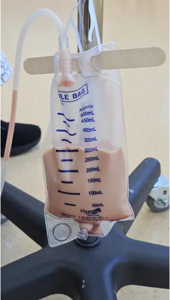 폐에 물이 차는 원인 증상 물참 관리 포인트에 대한 건강정보_3