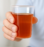 혈뇨가 나오는 이유