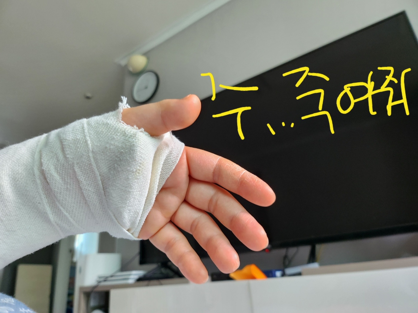 골절 손목부음 뼈 부러졌을때