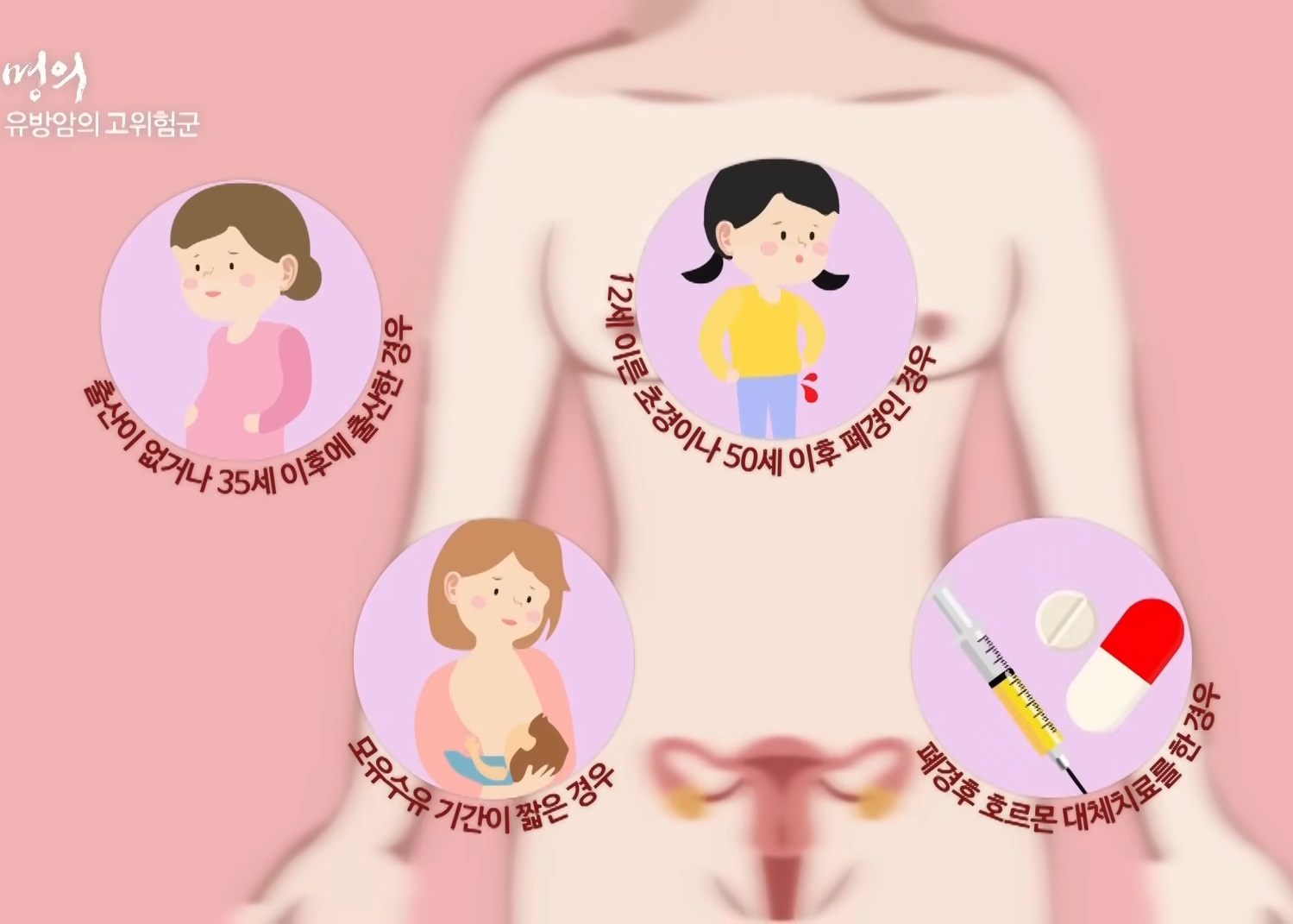 유방암-우상욱-교수