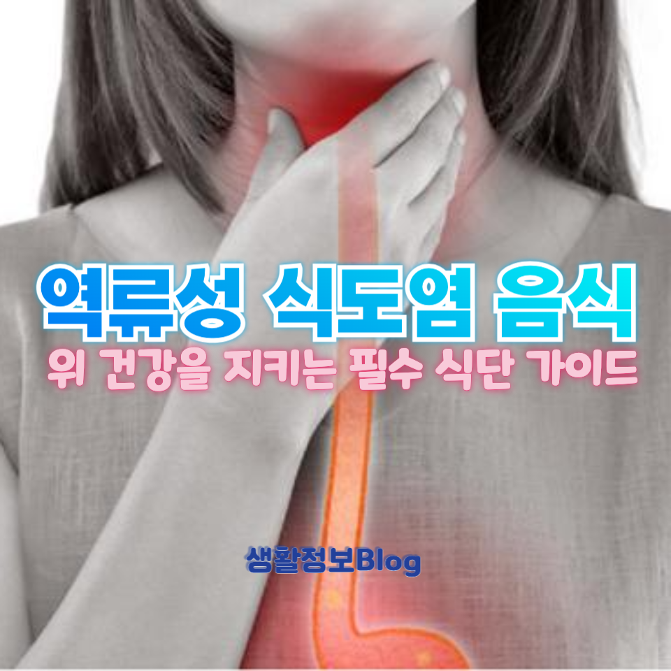 역류성 식도염에 좋은 음식