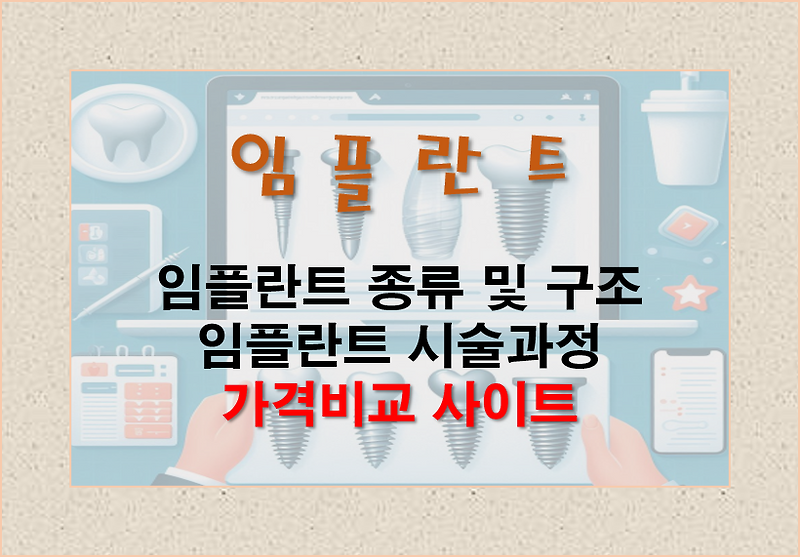 임플란트 가격 비교 사이트 안내