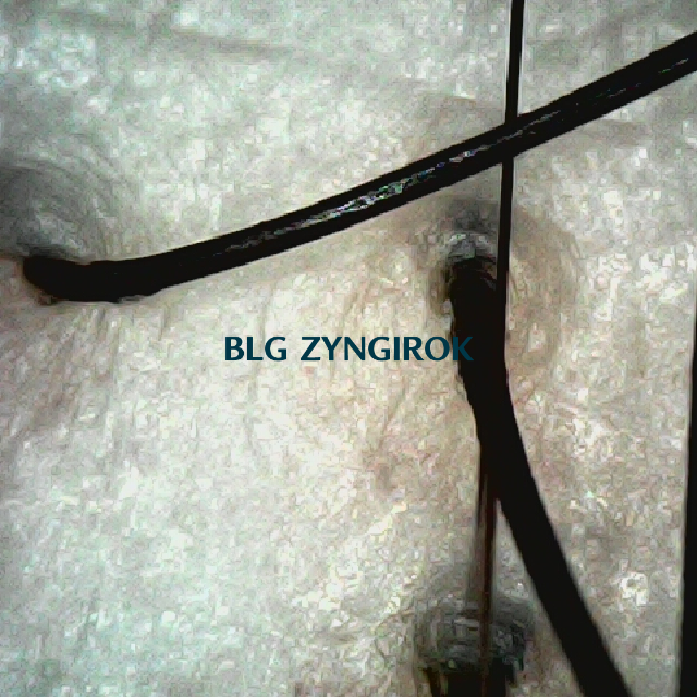 탈모 극복 프로젝트 - 뒷머리 두피모습이다.