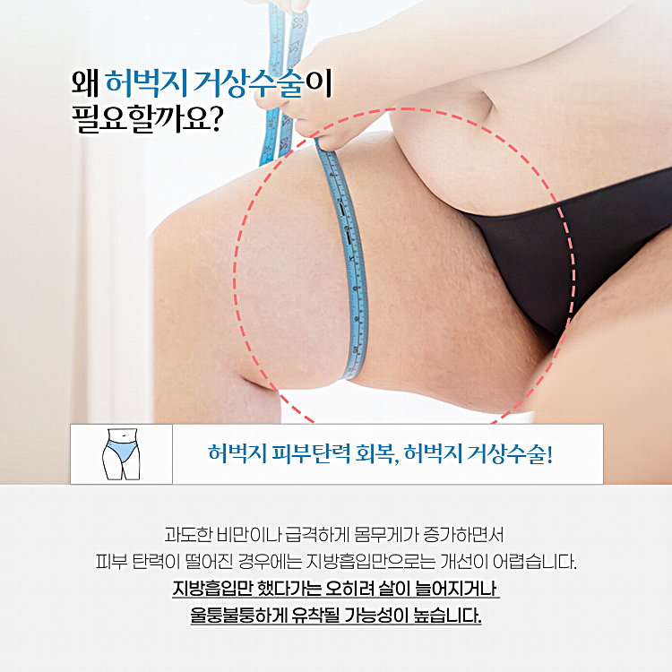 과도한 비만이나 급격하게 몸무게가 증가하면서 피부 탄력이 떨어진 경우에는 지방흡입만으로는 개선이 어렵습니다. 
지방흡입만 했다가는 오히려 살이 늘어지거나 울퉁불퉁하게 유착될 가능성이 높습니다.