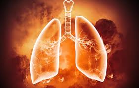 폐에 물이 차는 원인