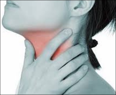 목이 따끔거리는 증상 04