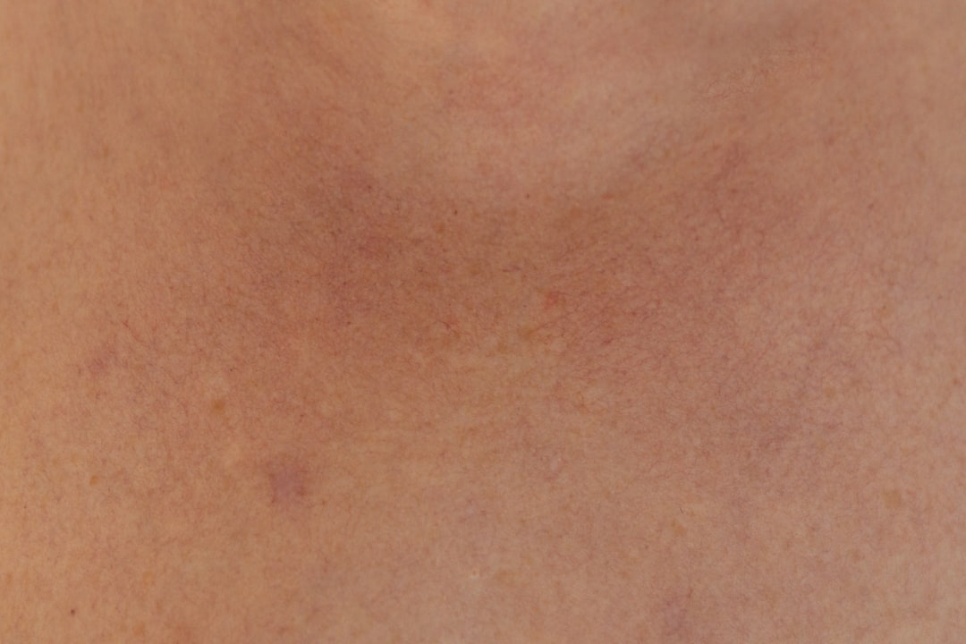 Skin tone