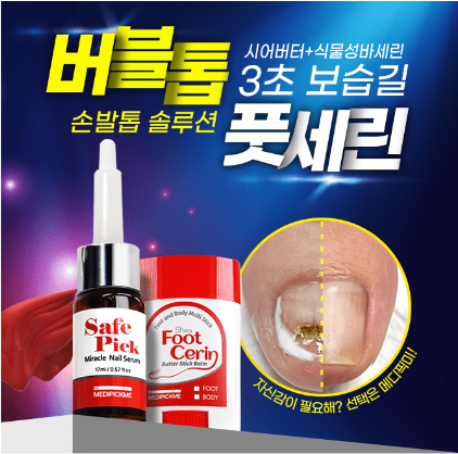 캐시워크-메디픽미-손발톱-퀴즈-썸네일