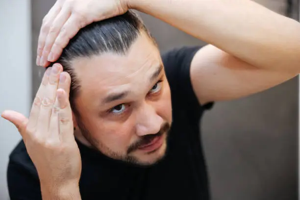 탈모 예방 방법