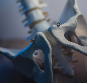 통풍 치료법 진단 기준 합병증