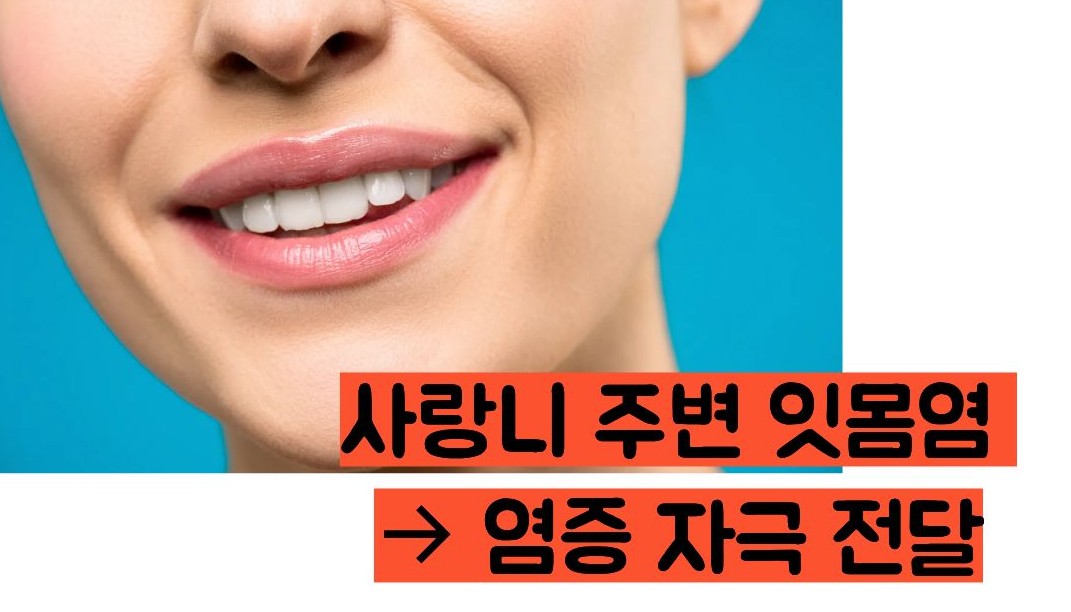 이빨이 시린 이유