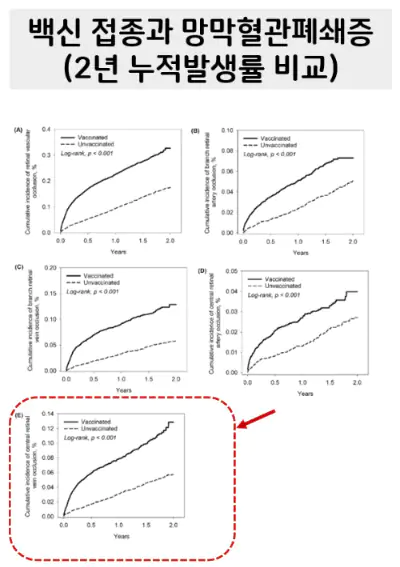 망막혈관폐쇄증 코로나 백신 부작용 논문, 이덕희 경북의대 교수