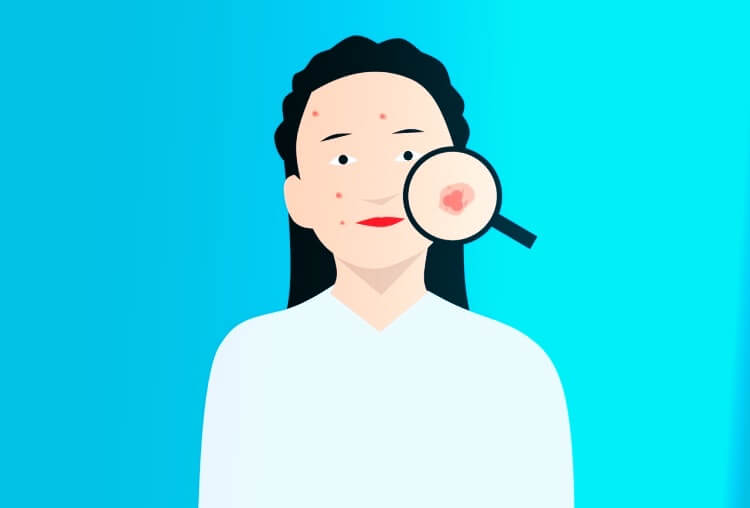 얼굴에-두드러기-난-여자-캐릭터