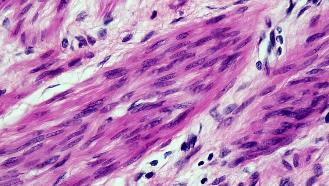 Smooth muscle
