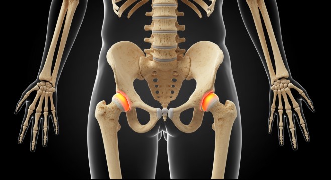 구멍난 뼈를 꽉 채우는 음식들 (칼슘, 비타민D, 단백질까지 한 번에!)